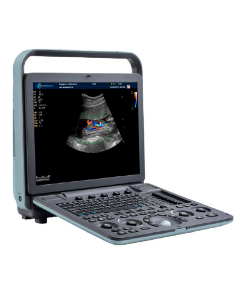 Ecógrafo P11 PLUS